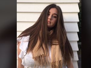 Viral Wanita Dulu Obesitas Kini Ramping, Transformasinya Bikin Takjub