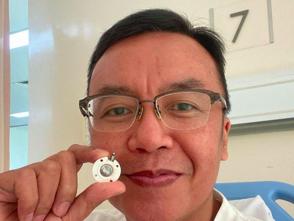 Puji Tuhan... Selesai Rangkaian Pengobatan Kanker Langka Ari Lasso Puji Tuhan... Selesai Rangkaian Pengobatan Kanker Langka Ari Lasso