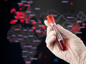 Alert dari IDI! Seluruh Dokter Diminta Waspada Gejala Cacar Monyet Alert dari IDI! Seluruh Dokter Diminta Waspada Gejala Cacar Monyet