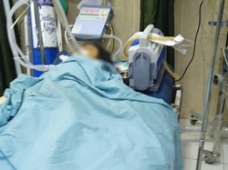 Tertimpa Pohon, Bocah Asal Sidemen Karangasem Meninggal Dunia