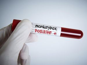 Cacar Monyet Sudah Darurat Global, Bakal Jadi Pandemi Seperti COVID-19? Cacar Monyet Sudah Darurat Global, Bakal Jadi Pandemi Seperti COVID-19?