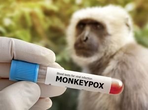 Apakah Cacar Monyet Berbahaya untuk Anak Sekolah?