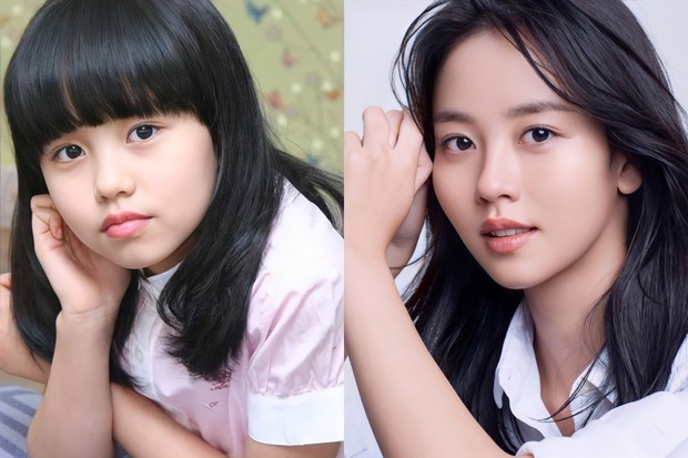 Kim So Hyun juga menjadi aktris cilik populer di mana kepopulerannya masih terus awet sampai ia beranjak dewasa.