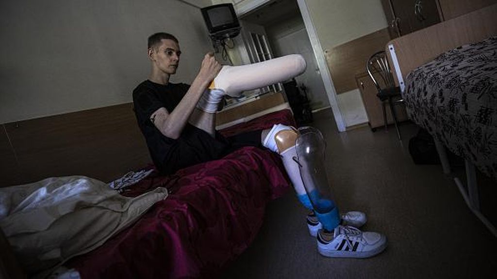 Kisah Daniyel Melnik, Tentara yang Hilang Tangan dan Kaki Lawan Rusia Kisah Daniyel Melnik, Tentara yang Hilang Tangan dan Kaki Lawan Rusia