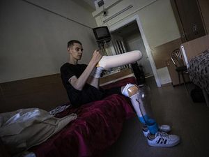 Kisah Daniyel Melnik, Tentara yang Hilang Tangan dan Kaki Lawan Rusia Kisah Daniyel Melnik, Tentara yang Hilang Tangan dan Kaki Lawan Rusia