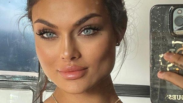 Petarung MMA Tercantik Babak Belur Pasca Pertandingan, Wajahnya Tak Dikenali