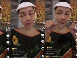 Kondisi Lucinta Luna Usai Permak Setting Suara, Ngaku Susah Nelen Kondisi Lucinta Luna Usai Permak Setting Suara, Ngaku Susah Nelen