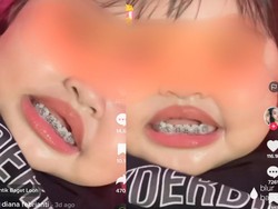 Bukan Dibehel, Sesimpel Ini Rawat Gigi Anak Balita Biar Tetap Sehat