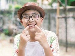 Kenali Fungsi dan Rekomendasi Warna Karet Behel yang Bagus