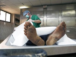 Otopsi atau Autopsi? Ini Istilah yang Baku dan Artinya