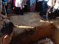 Dokter Forensik Jawab soal Otak Brigadir J Pindah ke Perut