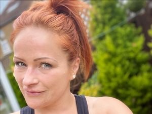 Ngeri! Kecanduan Tanning, Kepala Wanita Ini Berlubang karena Kanker Kulit