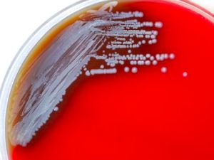 Bakteri Mematikan Ditemukan di AS, Sudah Ada Dua Kasus Penyakit