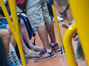Heboh Pengakuan Pasien yang Dituding Kena Monkeypox Berkeliaran di Kereta Heboh Pengakuan Pasien yang Dituding Kena Monkeypox Berkeliaran di Kereta