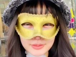 Potret Wajah Baru Lucinta Luna Usai Operasi Potong Leher-Ganti Kulit