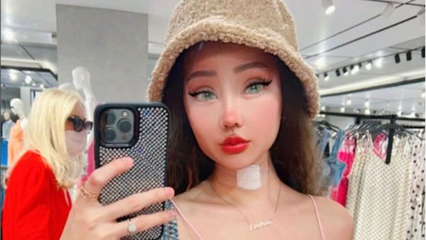 8 Penampilan Terbaru Lucinta Luna Pasca Operasi Potong Leher Hingga Kulit