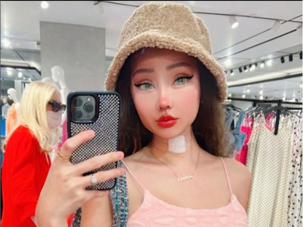 8 Penampilan Terbaru Lucinta Luna Pasca Operasi Potong Leher Hingga Kulit