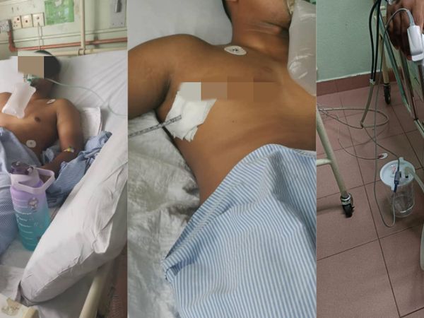 Bukti Vape Tak Lebih Baik dari Rokok, Ini Sederet Potret Kasus Paru-paru Bocor