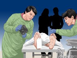 Dua Tembakan Fatal di Tubuh Brigadir J, Punya Siapa?