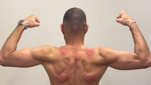 Rahasia Fisik Prima Karim Benzema: Bekam dan Tinju!