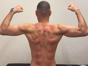 Rahasia Fisik Prima Karim Benzema: Bekam dan Tinju!