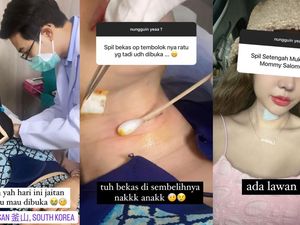 Kondisi Terkini Lucinta Luna Pasca Jahitan Khodam Dibuka Kondisi Terkini Lucinta Luna Pasca Jahitan Khodam Dibuka