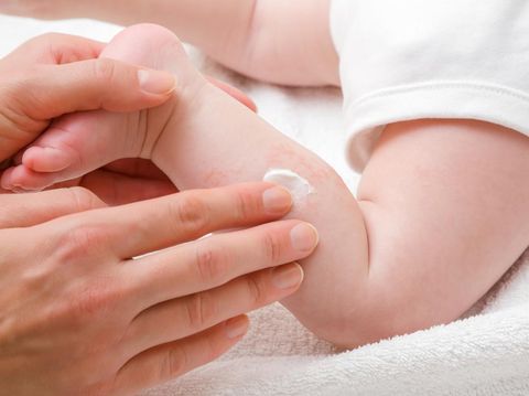 Penyebab dan cara mengobati ruam kulit anak.