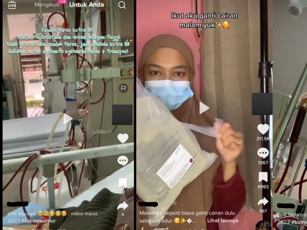 Viral Wanita Umur 20-an Kena Gagal Ginjal Kronis, Sampai Bolak-balik Cuci Darah