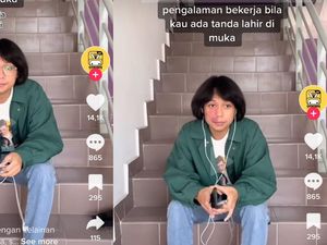 Asal Usul Tanda Lahir, Jadi Alasan Viral Pria Ditolak Kerja Asal Usul Tanda Lahir, Jadi Alasan Viral Pria Ditolak Kerja