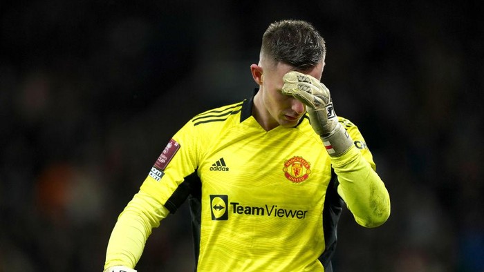 LEEDS, ENGLAND - APRIL 25: Dean Henderson of Manchester United warms up prior to the Premier League match between Leeds United and Manchester United at Elland Road on April 25, 2021 in Leeds, England. Sporting stadiums around the UK remain under strict restrictions due to the Coronavirus Pandemic as Government social distancing laws prohibit fans inside venues resulting in games being played behind closed doors. (Photo by Peter Powell - Pool/Getty Images)
