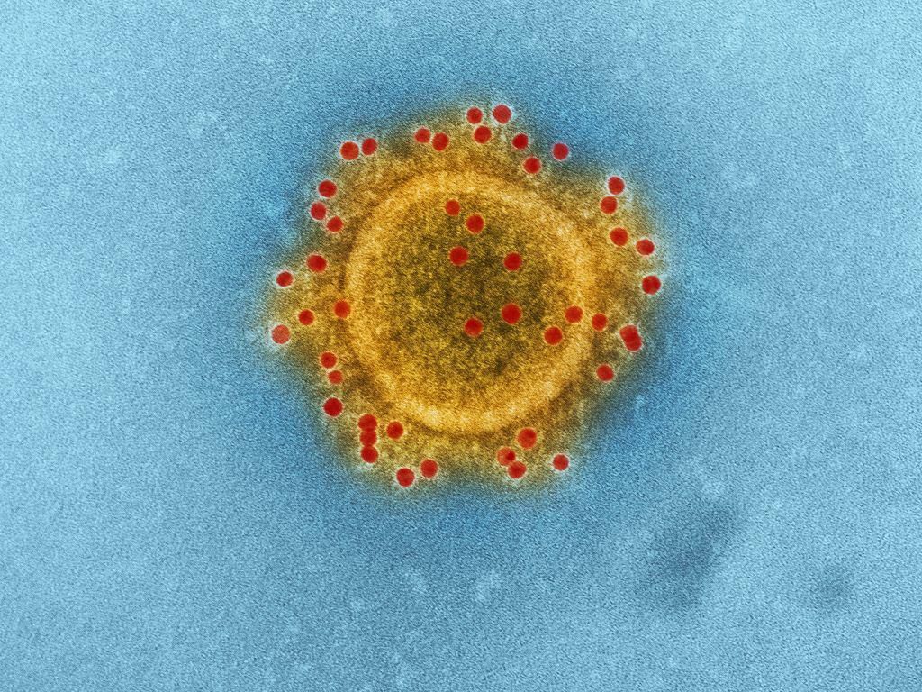 Sejarah Virologi, Cabang Ilmu yang Mempelajari Virus Sejarah Virologi, Cabang Ilmu yang Mempelajari Virus