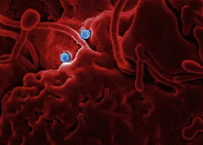 10 Foto Virus Jahat yang Dipotret Mikroskop, Bikin Terperangah