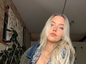 Model Ini Blak-blakan Idap Herpes Genital, Berakhir Dijuluki Super Spreader