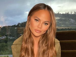 Chrissy Teigen Jalani Operasi Dahi karena Rambut Rontok Setelah Melahirkan Chrissy Teigen Jalani Operasi Dahi karena Rambut Rontok Setelah Melahirkan
