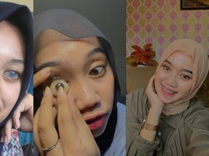 Viral Wanita Asal Yogya Mesti Ganti Mata Tiap 5 Tahun Sekali, Begini Kisahnya