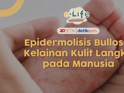 Ciri Penyakit Langka Epidermoliosis Bullosa, Kulit Serapuh Sayap Kupu-kupu