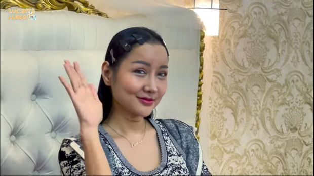 Lucinta Luna akhirnya menunjukkan wajah usai operasi plastik.