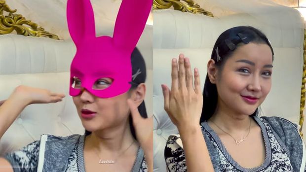 Lucinta Luna akhirnya menunjukkan wajah usai operasi plastik.