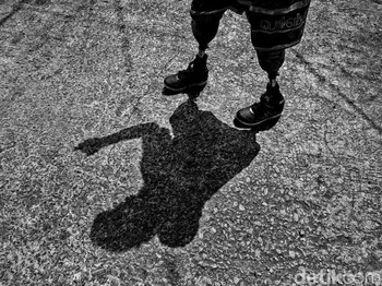 Ronald Regen, Difabel Perajin Kaki Palsu