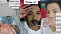 Cerita di Balik Viral Pria Madiun Kena Flu Singapura, Sempat Koma