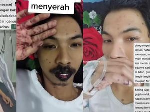 Terungkap, Ini Alasan Pria Madiun Viralkan Kondisinya yang Kena Flu Singapura Terungkap, Ini Alasan Pria Madiun Viralkan Kondisinya yang Kena Flu Singapura