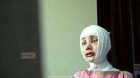 Potret Wajah Baru Lucinta Luna Pasca Operasi Ganti Kepala-Potong Leher