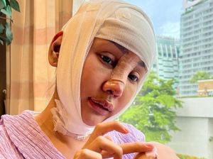 Curhat Lucinta Luna Usai Oplas Berkali-kali: Sakit Bak Sakaratul Maut