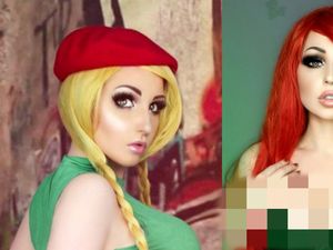 Model Ini Idap Penyakit Langka, Ikut OnlyFans Demi Bayar Tagihan RS