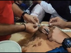 Damkar Lepaskan Cincin dari Jari Bocah SD yang Mulai Membengkak