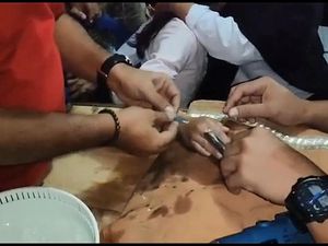 Damkar Lepaskan Cincin dari Jari Bocah SD yang Mulai Membengkak Damkar Lepaskan Cincin dari Jari Bocah SD yang Mulai Membengkak