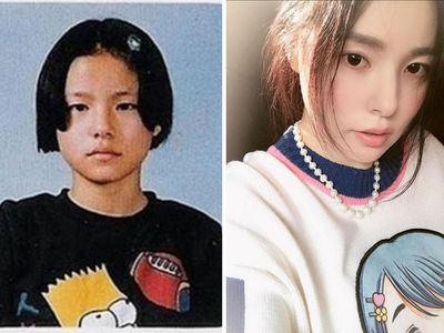 Potret 8 Artis Korea yang Ngaku Operasi Plastik, Ada Park Min Young
