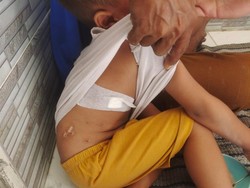 Monyet Teror Warga Driyorejo Gresik, Seorang Anak Terluka Diserang