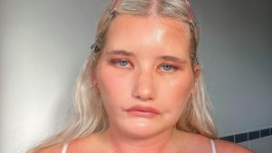 8 Foto Wanita Punya Sindrom Tak Bisa Senyum, Wajah Manyunnya Laris Jadi Model