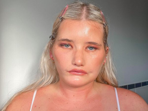 8 Foto Wanita Punya Sindrom Tak Bisa Senyum, Wajah Manyunnya Laris Jadi Model